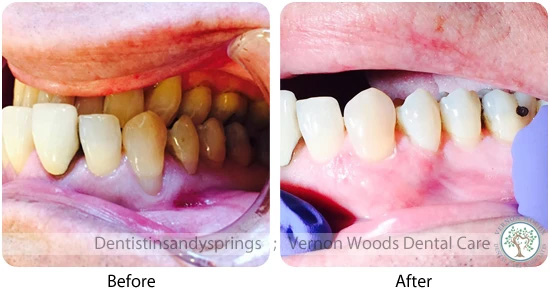 Vernon Woods Dental Implant Center | Pediatric Dentistry, Emergency Treatment and Oral Exams