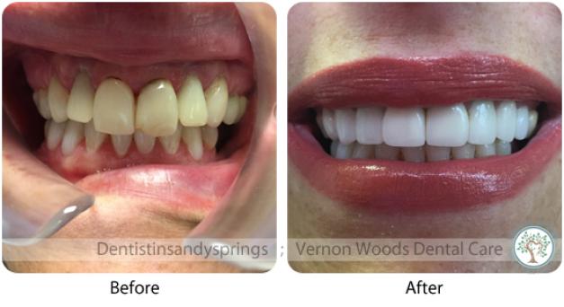 Before and After Photos